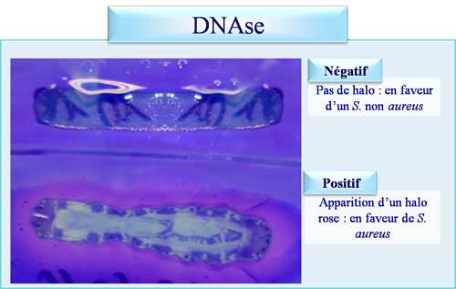 DNAse