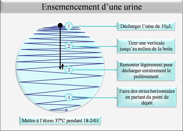 Ensemencement d'une urine