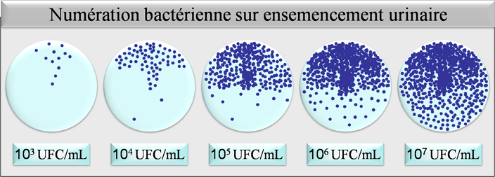 numération bactérienne sur ensemencement urinaire