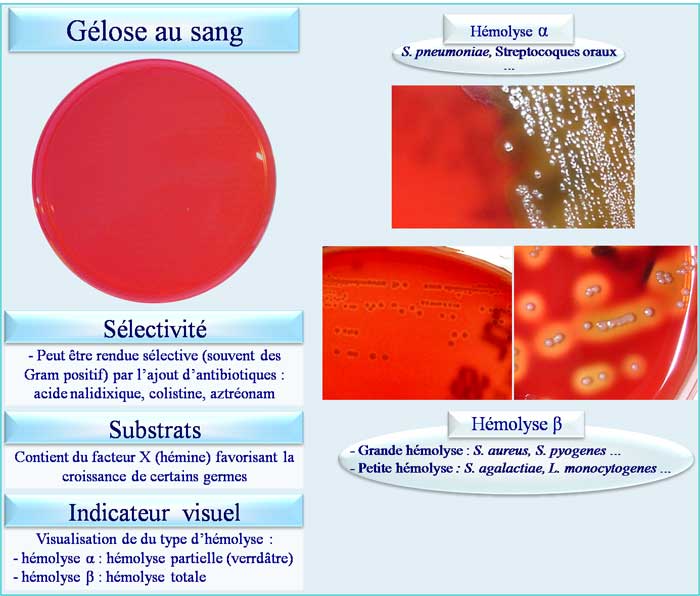 Gélose au sang