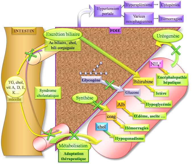 Physiopathologie de cirrhose décompensée