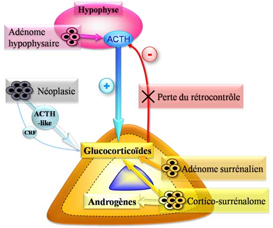 Etiologies d'un hypercorticisme (Syndrome de Cushing)