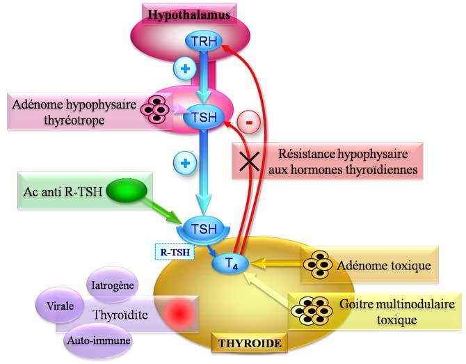 Etiologies des hyperthyroïdies