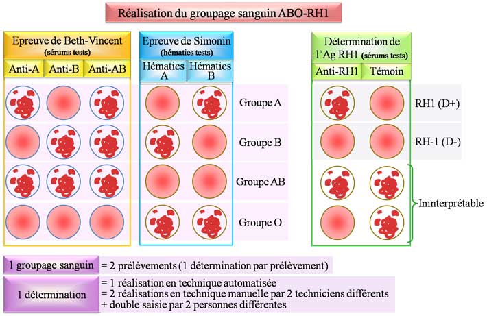 Réalisation du groupage sanguin ABO-RH1