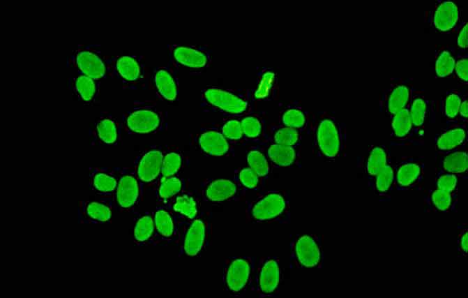 fluorescence anti-nucléaire homogène