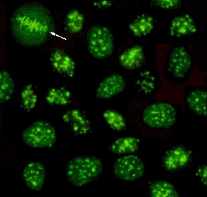 fluorescence anti-nucléaire mouchetée