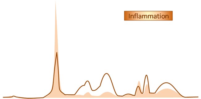 electrophorèse inflammation