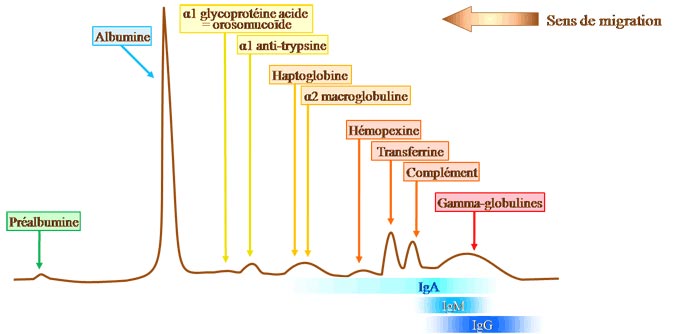 tracé électrophorétique normal