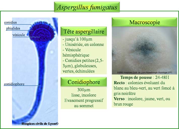 Aspergillus fumigatus