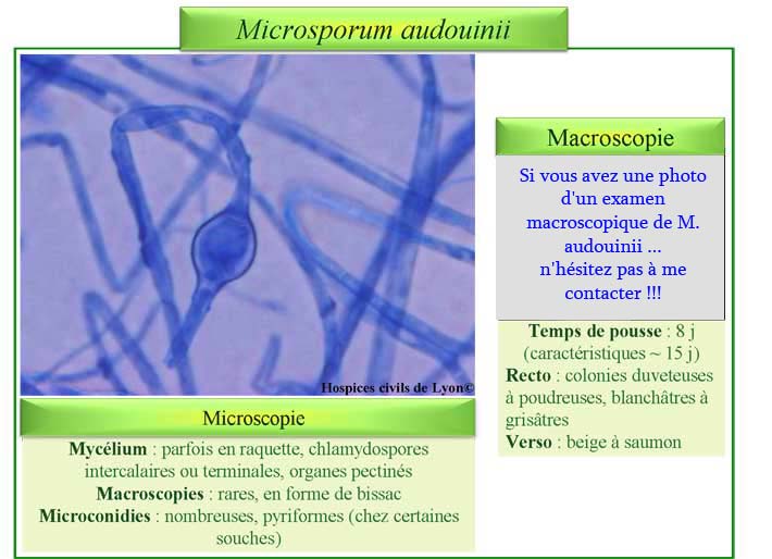 Microsporum audouinii