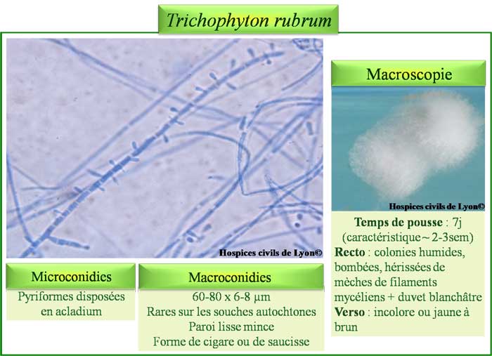 Trichophyton rubrum