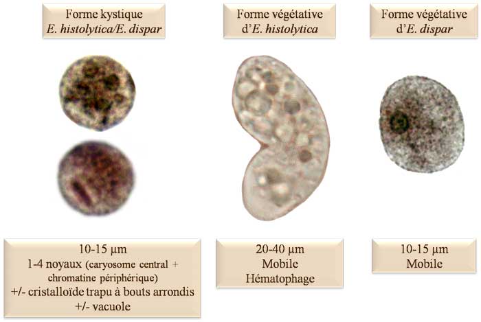 Entamoeba histolytica