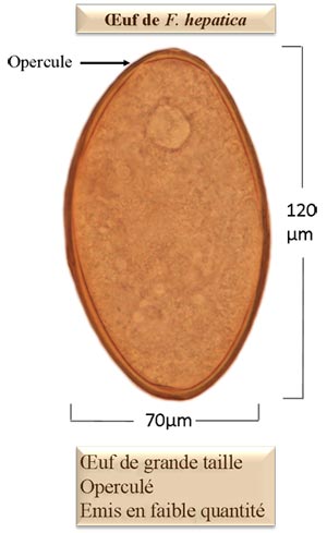 Fasciola hepatica