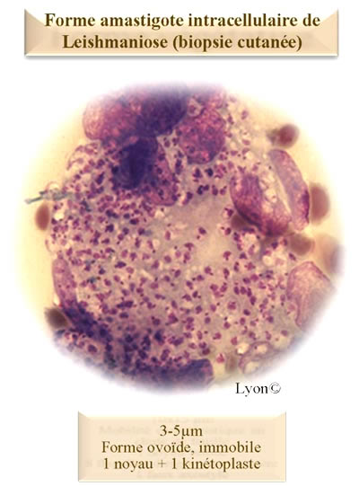 forme amastigote leishamie