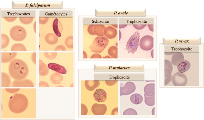 Plasmodium