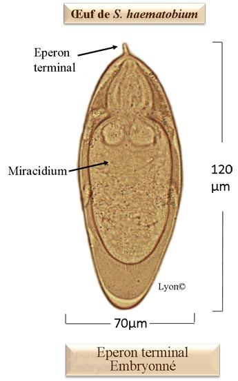 oeuf S. haematobium