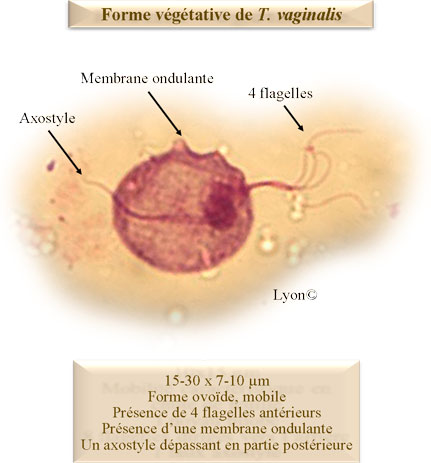 forme végétative Trichomonas vaginalis