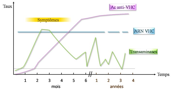 Sérologie d'une hépatite C chronique