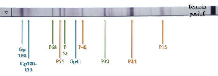 Western-blot VIH