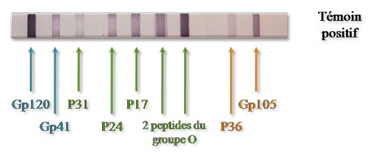 Exemple d’Immuno-Blot utilisant des protéines d’enveloppe du VIH-1 et du VIH-2