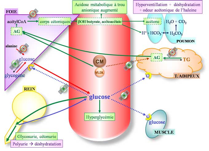 Mécanisme de l'acidocétose diabétique