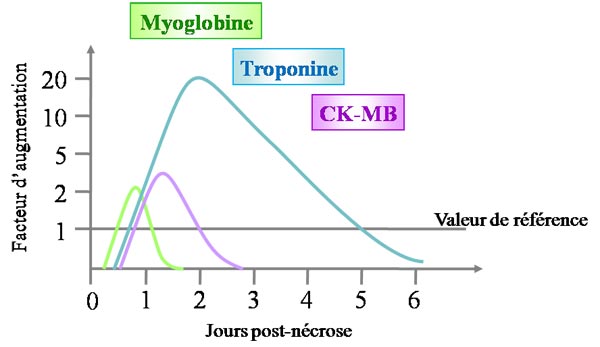 Cinétique des marqueurs de l'IDM